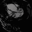 Collection uploader avatar